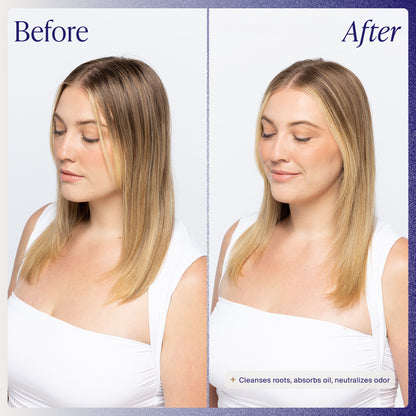 Micellar Cleansing Mist